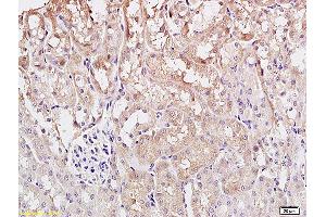 Formalin-fixed and paraffin embedded rat kidney tissue labeled with Anti ST2 Polyclonal Antibody, Unconjugated (ABIN680243) at 1:200 followed by conjugation to the secondary antibody and DAB staining (IL1RL1 anticorps  (AA 11-110))