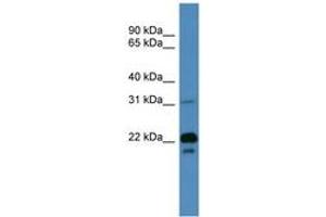Image no. 1 for anti-Brain Abundant, Membrane Attached Signal Protein 1 (BASP1) (AA 51-100) antibody (ABIN6746712)