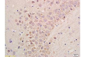 Formalin-fixed and paraffin embedded rat liver tissue labeled with Rabbit Anti-Substance P Polyclonal Antibodyat 1:200 followed by conjugation to the secondary antibody and DAB staining.