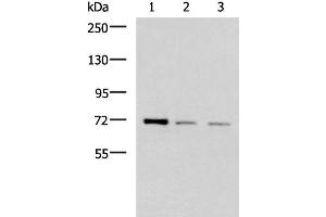 Western blot analysis of K562 HepG2 and Jurkat cell lysates using FOXK1 Polyclonal Antibody at dilution of 1:400 (Foxk1 anticorps)
