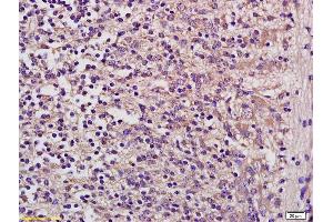 Formalin-fixed and paraffin embedded mouse embryo labeled with Anti GUSB/beta glucuronidase Polyclonal Antibody, Unconjugated (ABIN873149) at 1:200 followed by conjugation to the secondary antibody and DAB staining