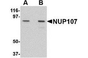 Western Blotting (WB) image for anti-Nucleoporin 107kDa (NUP107) (C-Term) antibody (ABIN1030552) (NUP107 anticorps  (C-Term))