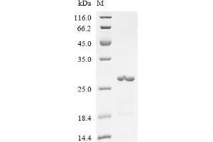 (Tris-Glycine gel) Discontinuous SDS-PAGE (reduced) with 5 % enrichment gel and 15 % separation gel.