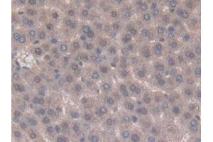Used in DAB staining on fromalin fixed paraffin- embedded kidney tissue