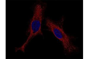 Indirect immunostaining of HELA cells (dilution 1 : 100; red). (Syntaxin 4 anticorps  (Cytoplasmic Domain))