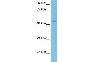 Host:  Rabbit  Target Name:  ETV4  Sample Tissue:  Human Jurkat Whole Cell  Antibody Dilution:  1ug/ml (ETV4 anticorps  (Middle Region))