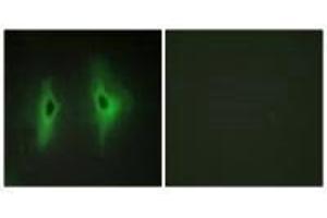 Immunofluorescence analysis of HeLa cells, using DGKH antibody. (DGKH anticorps)