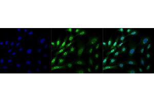 Immunocytochemistry/Immunofluorescence analysis using Mouse Anti-Ubiquitin Monoclonal Antibody, Clone FK1 (ABIN5024470). (Ubiquitin anticorps  (FITC))