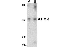 Western Blotting (WB) image for anti-Hepatitis A Virus Cellular Receptor 1 (HAVCR1) (Middle Region) antibody (ABIN1031124) (HAVCR1 anticorps  (Middle Region))