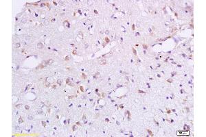 Formalin-fixed and paraffin embedded rat brain labeled with Anti-BCAT1 Polyclonal Antibody, Unconjugated (ABIN718856) at 1:200 followed by conjugation to the secondary antibody and DAB staining. (BCAT1 anticorps  (AA 321-386))