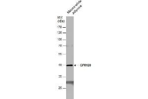 WB Image GPR120 antibody detects GPR120 protein by western blot analysis.
