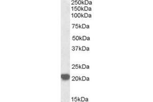 Western Blotting (WB) image for anti-Ras-Related C3 Botulinum Toxin Substrate 2 (Rho Family, Small GTP Binding Protein Rac2) (RAC2) (C-Term) antibody (ABIN2465289) (RAC2 anticorps  (C-Term))