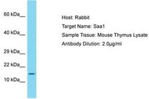 Image no. 1 for anti-Serum Amyloid A1 (SAA1) (AA 51-100) antibody (ABIN6750312) (SAA1 anticorps  (AA 51-100))