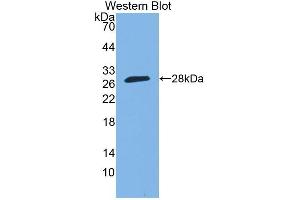 Detection of Recombinant SP140, Human using Polyclonal Antibody to Sp140 Nuclear Body Protein (SP140) (SP140 anticorps  (AA 443-655))