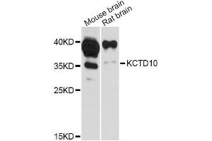 Western blot analysis of extracts of various cell lines, using KCTD10 Antibody (ABIN5998054) at 1:3000 dilution. (KCTD10 anticorps)