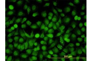 Immunofluorescence of monoclonal antibody to MAPK9 on HeLa cell.