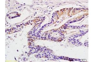 Immunohistochemistry (Paraffin-embedded Sections) (IHC (p)) image for anti-Cancer/testis Antigen 2 (CTAG2) (AA 121-210) antibody (ABIN721135) (CTAG2 anticorps  (AA 121-210))