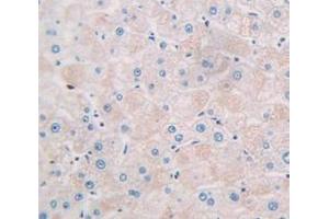 Used in DAB staining on fromalin fixed paraffin- embedded Kidney tissue (CCL26 anticorps  (AA 24-94))