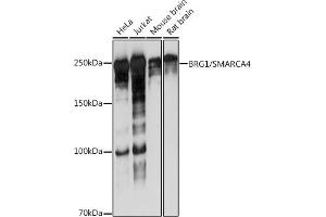 Western blot analysis of extracts of various cell lines, using BRG1/SM antibody (ABIN7270655) at 1:1000 dilution. (SMARCA4 anticorps)