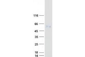 Validation with Western Blot