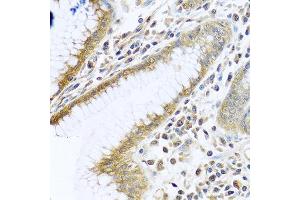 Immunohistochemistry of paraffin-embedded human stomach using TMEM189 antibody at dilution of 1:100 (40x lens). (TMEM189 anticorps)