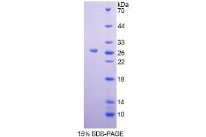 SDS-PAGE analysis of Human GCNF Protein. (NR6A1 Protéine)