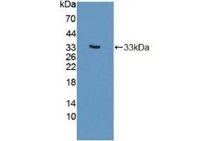 Detection of Recombinant PLCb2, Human using Polyclonal Antibody to Phospholipase C Beta 2 (PLCb2) (Phospholipase C beta 2 anticorps  (AA 1-250))