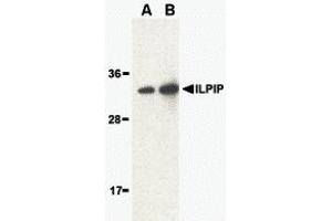Western Blotting (WB) image for anti-STE20-Related Kinase Adaptor beta (STRADB) (Middle Region) antibody (ABIN1030961)