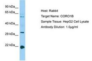Image no. 1 for anti-Coronin, Actin Binding Protein, 1B (CORO1B) (C-Term) antibody (ABIN6750172) (CORO1B anticorps  (C-Term))