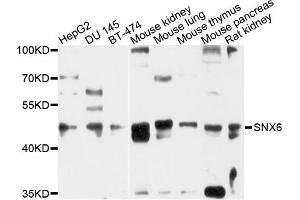 Western blot analysis of extracts of various cells, using SNX6 antibody. (SNX6 anticorps)