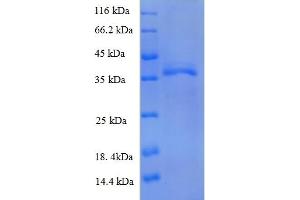 SDS-PAGE (SDS) image for Major Histocompatibility Complex, Class I, B (HLA-B) (AA 25-308), (partial) protein (His tag) (ABIN5712958)