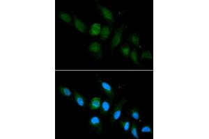 Immunofluorescence analysis of U2OS cell using HLA-A antibody.