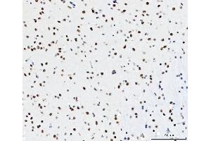 IHC analysis of CPSF6 using anti-CPSF6 antibody (ABIN7601897).