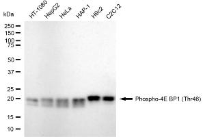 Western blotting analysis using phospho-4E BP1 (Thr46) antibody (ABIN7798530). (Recombinant eIF4EBP1 anticorps  (pThr46))