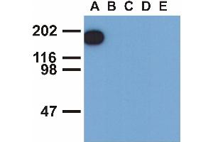 Western blotting analysis of EGFR (phospho-Tyr1173) by mouse monoclonal antibody EM-13 inEGF-treated A431 (A), CALU-3 (B), MCF-7 (C), Jurkat (D) and Ramos (E) cell lines (reduced conditions). (EGFR anticorps  (Tyr1173))