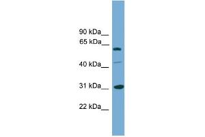 WB Suggested Anti-RAD1 Antibody Titration: 0. (RAD1 anticorps  (Middle Region))
