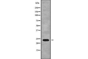 Western blot analysis of RAB15 using RAW264. (RAB15 anticorps  (Internal Region))