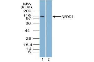 Image no. 1 for anti-Neural Precursor Cell Expressed, Developmentally Down-Regulated 4, E3 Ubiquitin Protein Ligase (NEDD4) (AA 950-1000) antibody (ABIN960275) (NEDD4 anticorps  (AA 950-1000))
