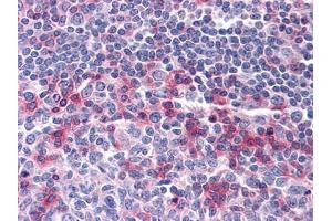 Immunohistochemical analysis of paraffin-embedded human Tonsil tissues using anti-CD69 mouse mAb (CD69 anticorps)