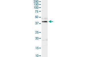 ADA MaxPab rabbit polyclonal antibody. (ADA anticorps  (AA 1-363))