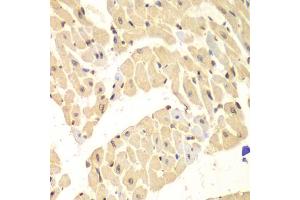 Immunohistochemistry of paraffin-embedded mouse heart using HIF1AN antibody (ABIN5973179) at dilution of 1/100 (40x lens). (HIF1AN anticorps)