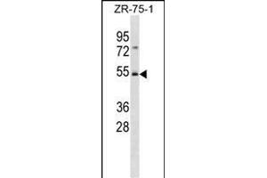 FBXW4 Antibody (C-term) (ABIN1881340 and ABIN2839057) western blot analysis in ZR-75-1 cell line lysates (35 μg/lane). (FBXW4 anticorps  (C-Term))