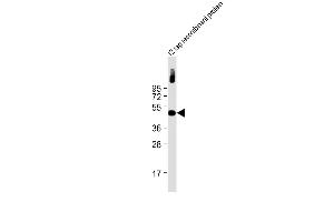 Anti-Myc Tag Antibody at 1:2000 dilution + 12 tag recombinant protein lysate Lysates/proteins at 20 μg per lane. (Myc Tag anticorps)