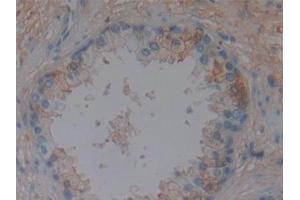 Detection of DBP in Human Prostate Tissue using Polyclonal Antibody to Vitamin D Binding Protein (DBP)