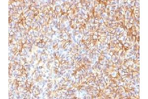 IHC testing of FFPE human pancreas with Spectrin beta III antibody (clone SPTBN2/1584).