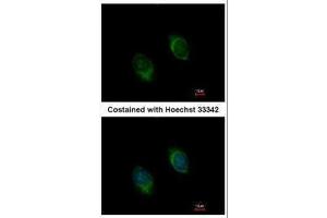 anti-Bone Morphogenetic Protein 4 (BMP4) antibody