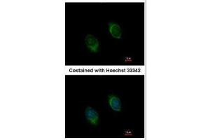 ICC/IF Image Immunofluorescence analysis of methanol-fixed HeLa, using BMP4, antibody at 1:100 dilution. (BMP4 anticorps)