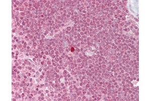 Anti-ZBTB7A antibody IHC of human thymus. (ZBTB7A anticorps  (N-Term))