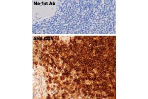 Immunohistochemistry (IHC) image for anti-CD5 (CD5) (AA 105-210) antibody (ABIN7272988) (CD5 anticorps  (AA 105-210))