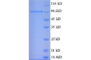 SDS-PAGE (SDS) image for Glutamate Decarboxylase 2 (Pancreatic Islets and Brain, 65kDa) (GAD2) (AA 1-585), (full length) protein (His tag) (ABIN5709545)